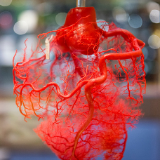 Plastinatie