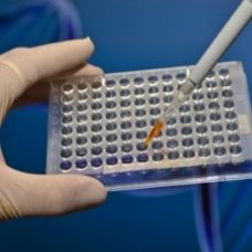 Serum well cells