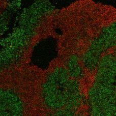gut brain on a chip