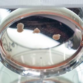 Organoids