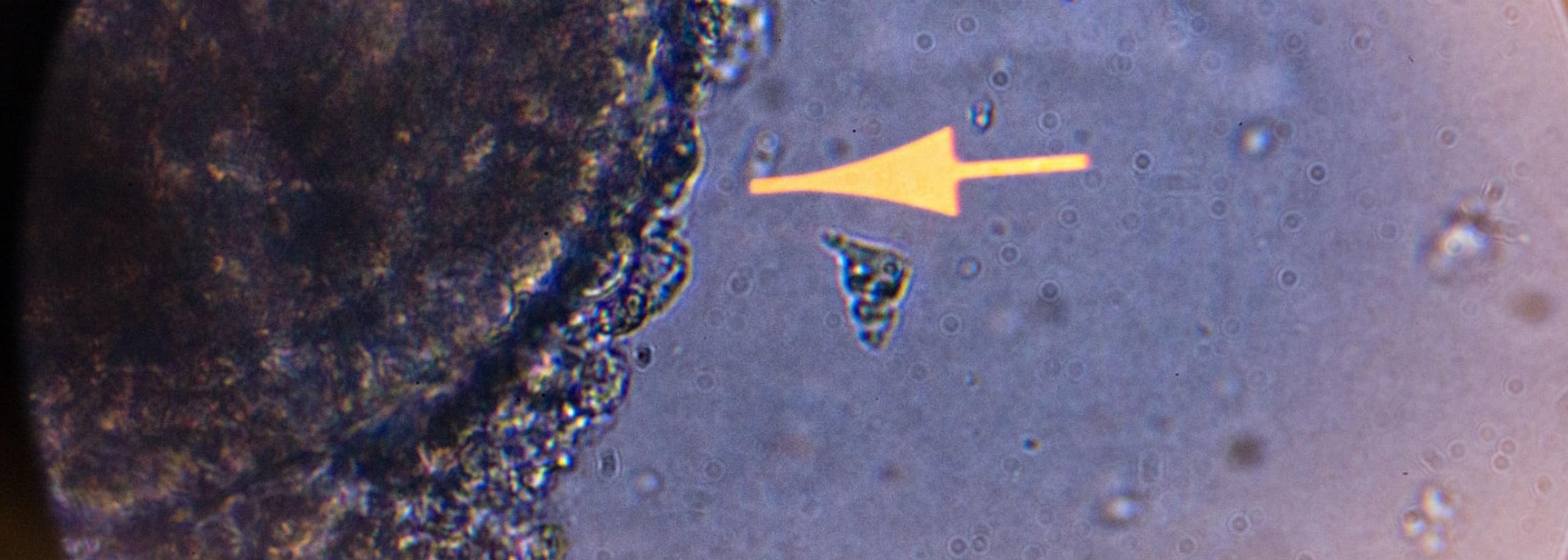Organoid Katja