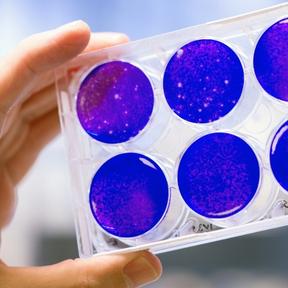 Rondje afbeelding website 288 x 288 (Organoids Katja) Organoids Katja