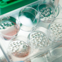 organoid