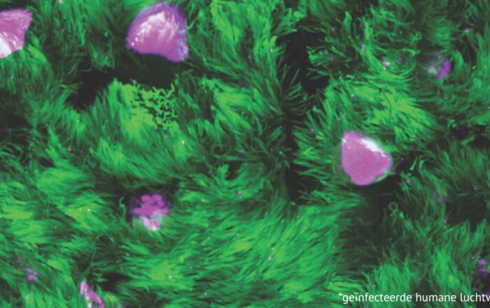mers virus