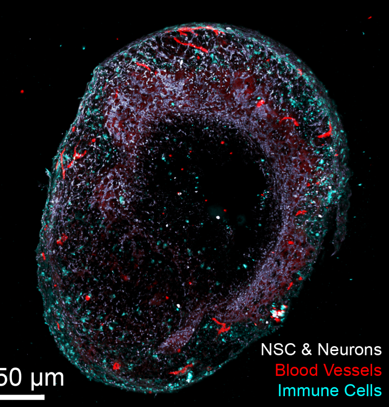 nsc neurons neuronen en bloedvaten in de hersenen